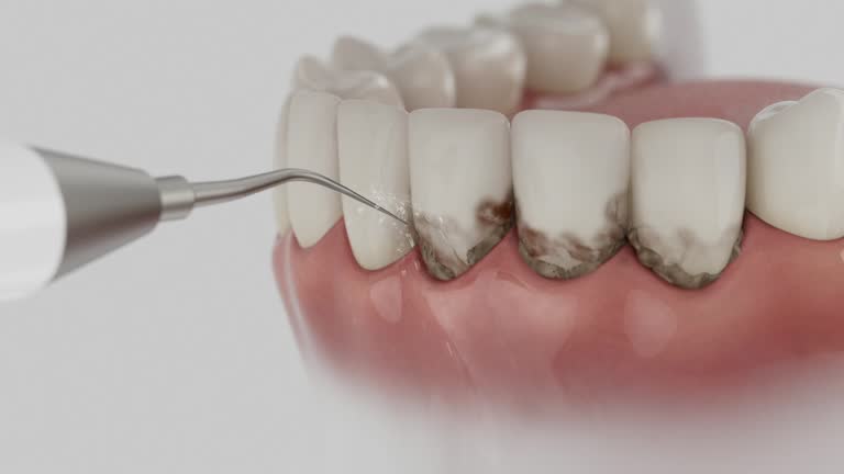 Trusted Dental Implants service in Waverly, MN - Dentist Open Now